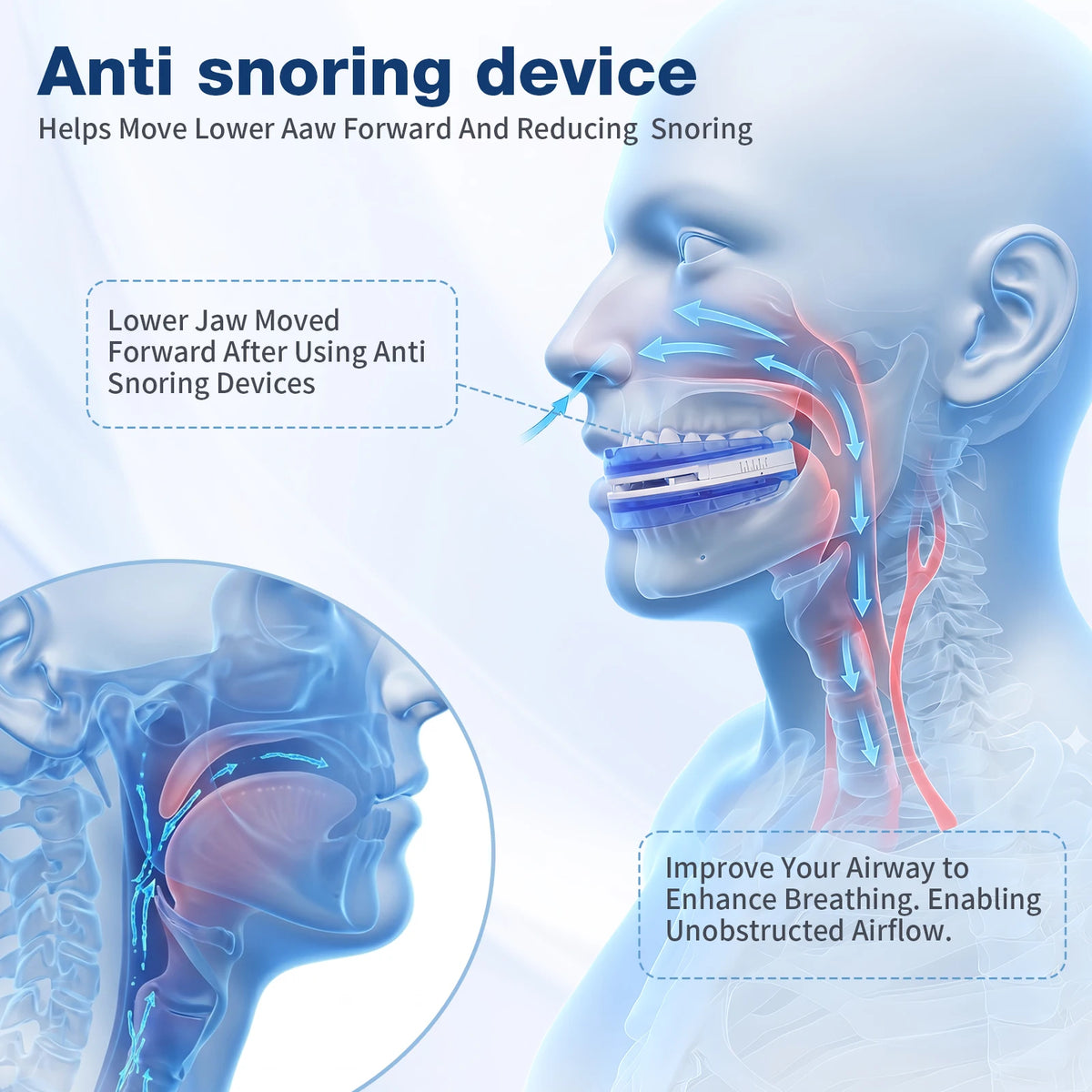 Adjustable Anti Snoring Mouthpiece for Adults, Boil and Bite Custom Fit Sleep Aid, 1mm-6mm Jaw Advancement Oral Device, Open Airflow Design, Reusable Night Guard with Portable Storage Case for Home Travel
