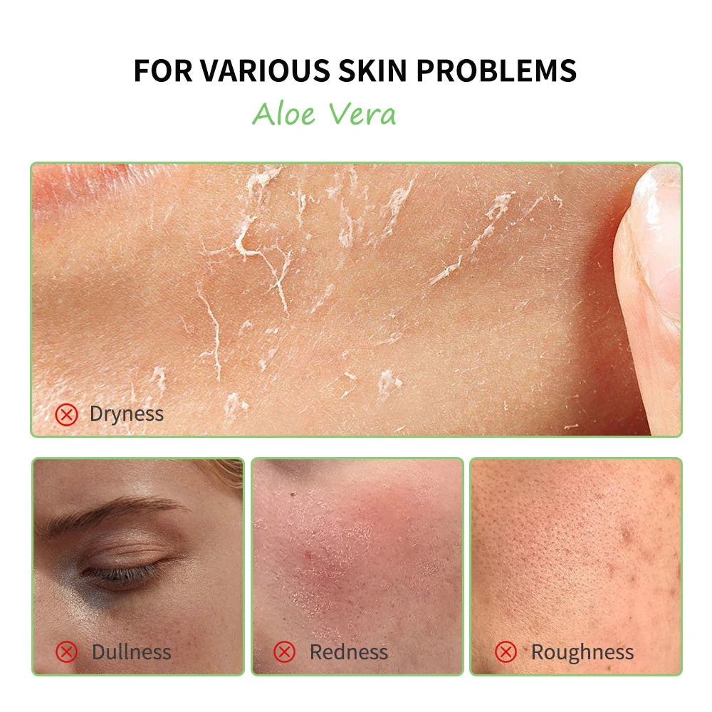 Aloe Vera 5 Pcs Skin Care Set Cleanser Toner Serum Eye Cream Gel Deeply Moisturizing Soothing Hydrating Calming Daily Facial Care